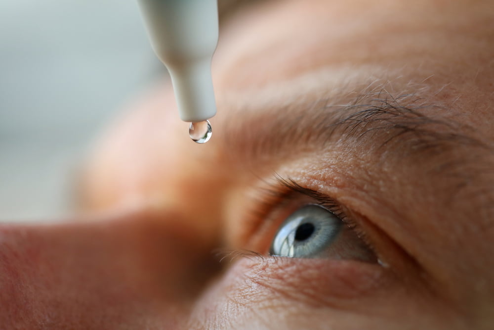 A close-up of an eye with a drop of liquid falling from an eyedropper, demonstrating the application of eye medication or drops - Glaucoma Treatment A close-up of an eye with a drop of liquid falling from an eyedropper, demonstrating the application of eye medication or drops - Glaucoma Treatment